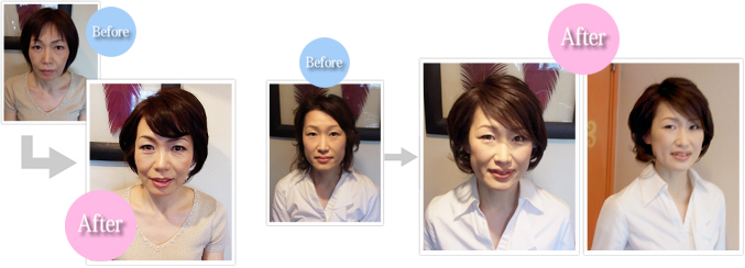 before-after02